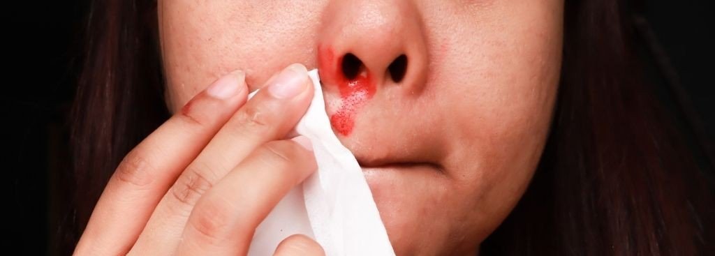 humidifier for nosebleeds