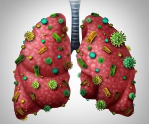 can a humidifier cause pneumonia